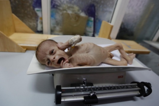 Yemen starting child1