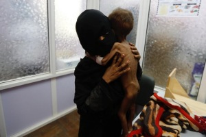 Yemen starving child4