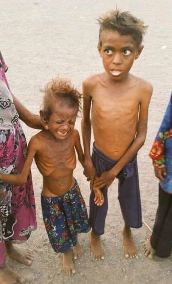 famine2-yemen